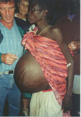 The French Health Minister and a pregnant boma woman in a vulnerable condition